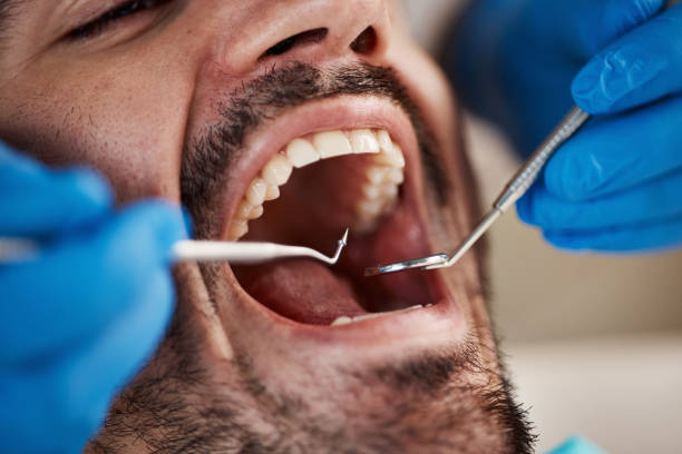 Best Emergency Root Canal Treatment in Montevideo, MN